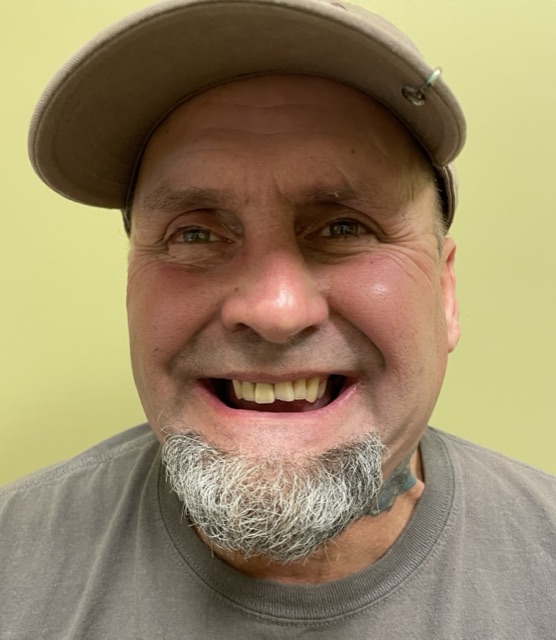 Leroy S. before treatment