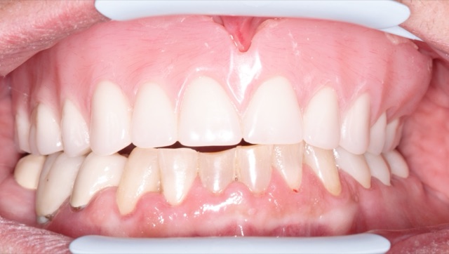 Tammy C. before treatment