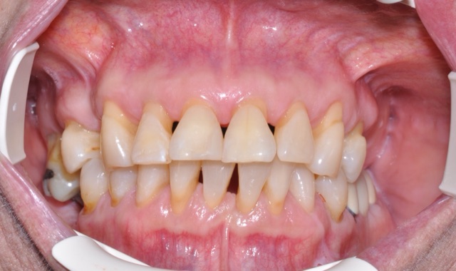 Sandra C. before treatment