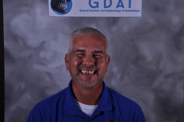 Brad S. before treatment