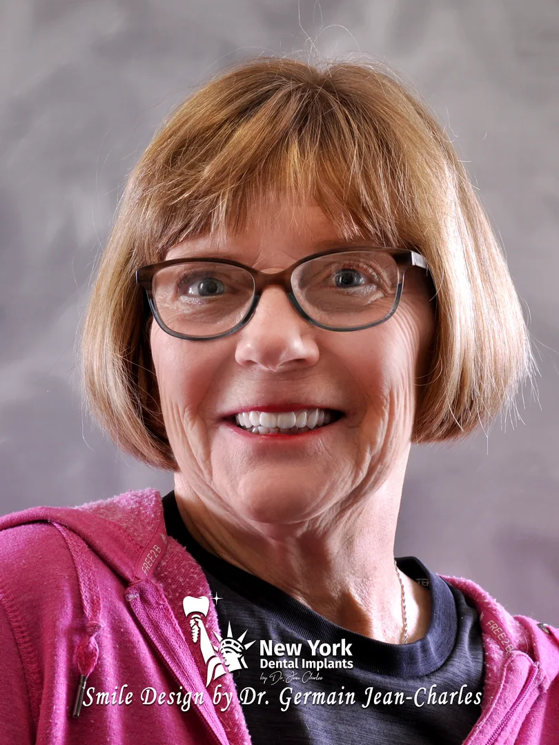 Deborah B. after all-on-4 treatment at New York Dental Implants