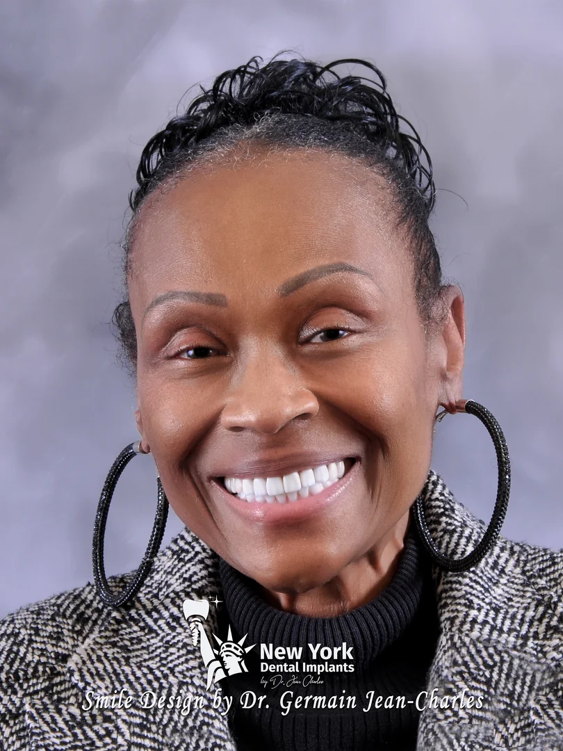 Hattie B. after full mouth restoration treatment at New York Dental Implants