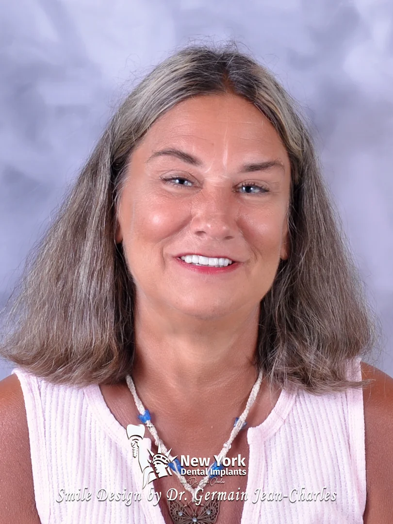 Tammy C. after implant bridge treatment at New York Dental Implants