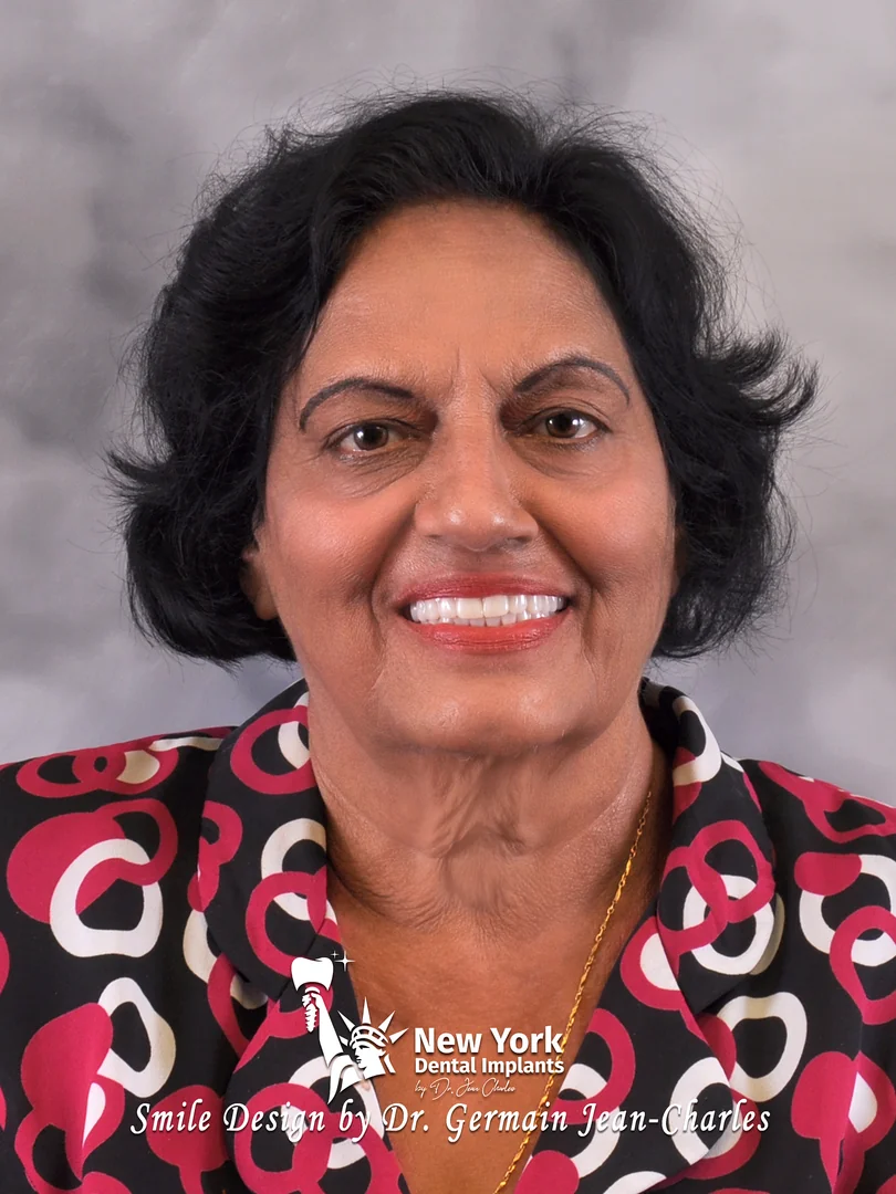 Saroj D. after complete restoration treatment at New York Dental Implants