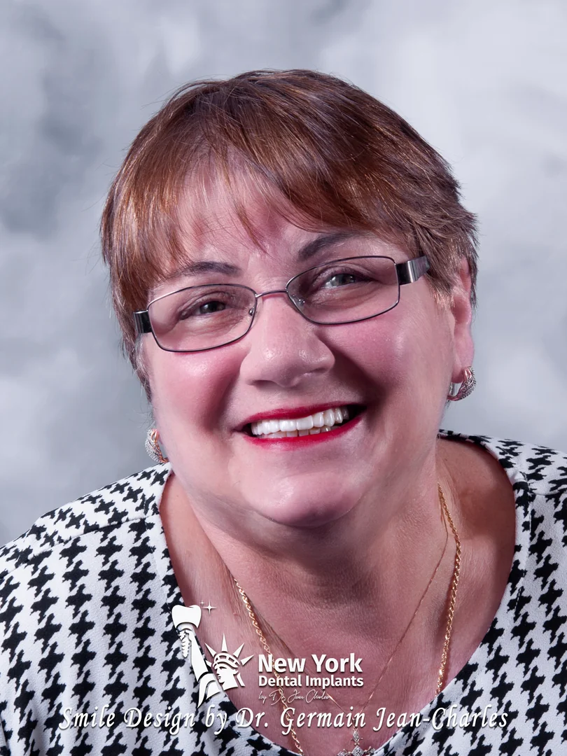 J. Sita after implant dentures treatment at New York Dental Implants