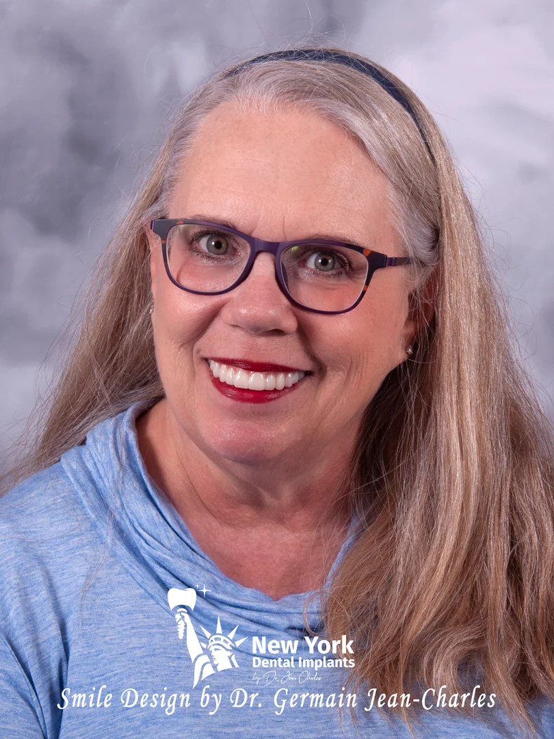 Sandra C. after all-on-4 treatment at New York Dental Implants