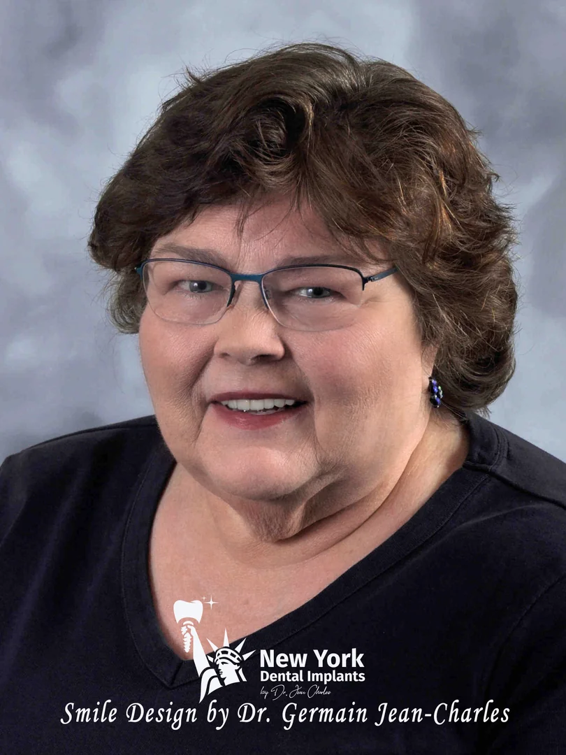 Sandy S. after full mouth restoration treatment at New York Dental Implants