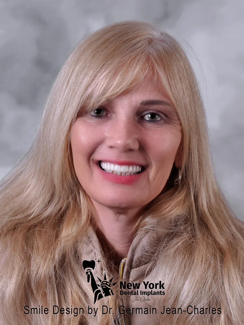 Tammy H. after complete restoration treatment at New York Dental Implants